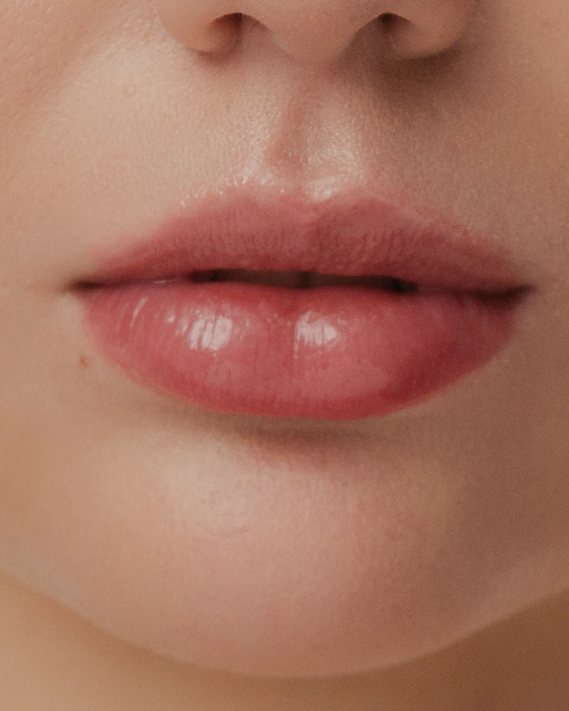 FIG LIPPER