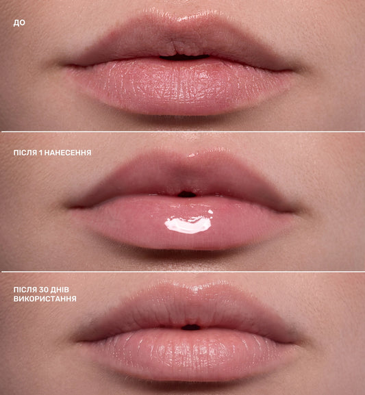 LIPSS COMFORT&PROTECT BALM